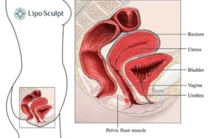 Treatment For A Leaky Bladder 2 How EM Chair treatment Ledbury can help Leaky bladder issues. Read more now!