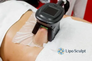 Does Fat Freezing At Home Work? 3 Fat freezing at home from Lipo Sculpt Ledbury